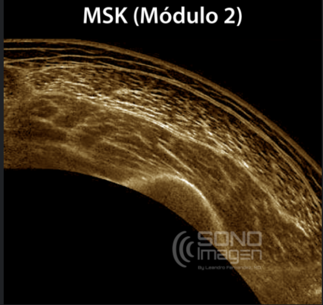 Curso MSK 2 Miembro Inferior. Modo Virtual