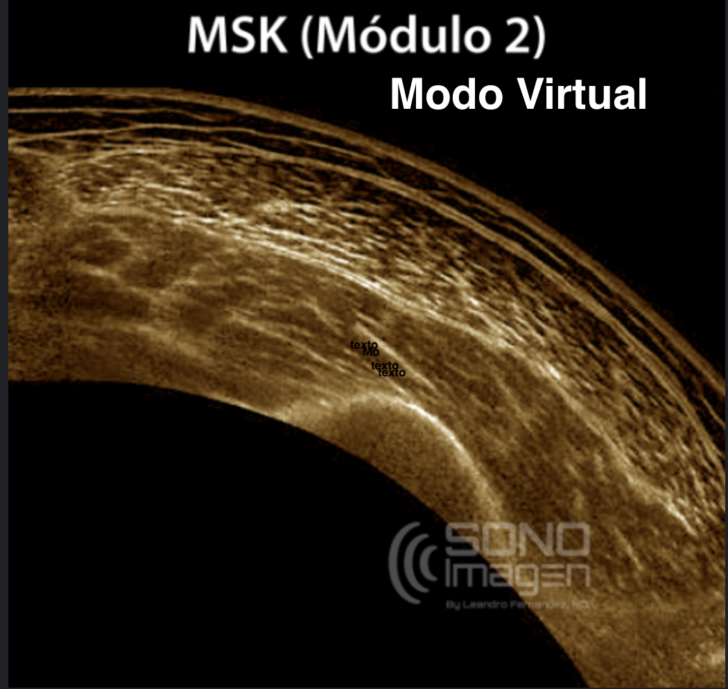 Curso MSK 2 Miembro Inferior. Modo Virtual