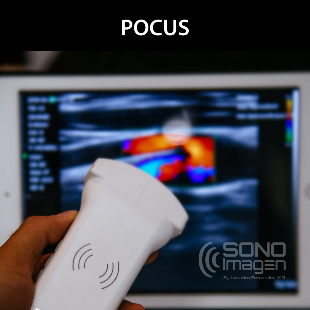 Curso POCUS (Point-Of-Care) MODO VIRTUAL