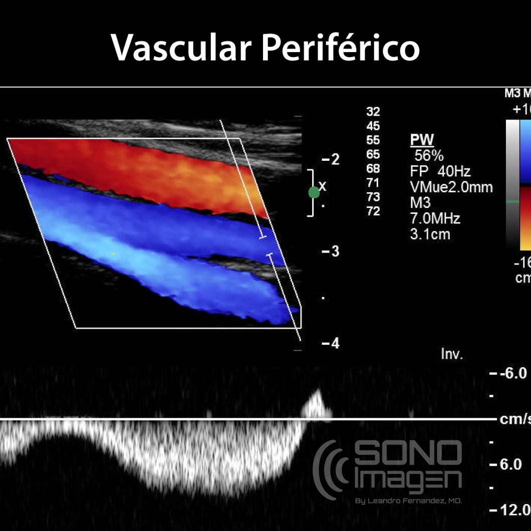 Curso Doppler Vascular Periférico MODO VIRTUAL
